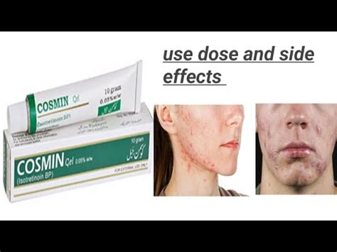 Isotretinoin: Uses, Dosage, Side Effects and More.
